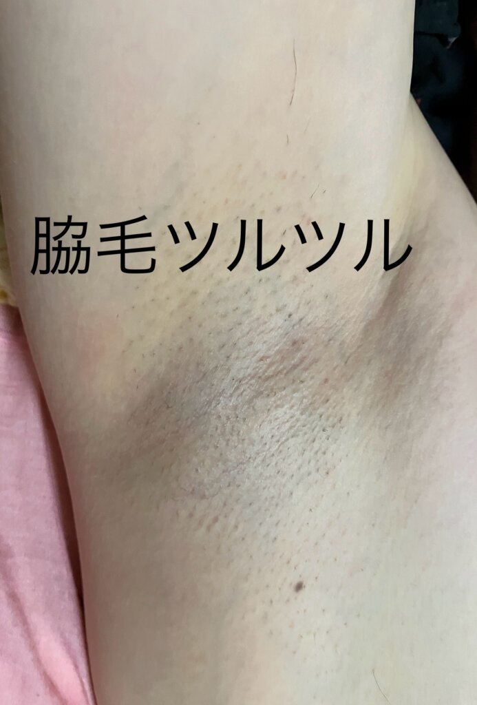 脇毛ツルツル